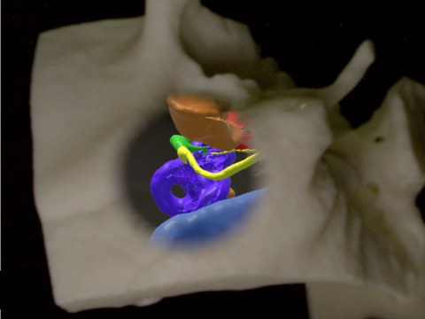 Figure from Seeing Through the Surface, showing depth-perception visualization techniques for augmented microscopy